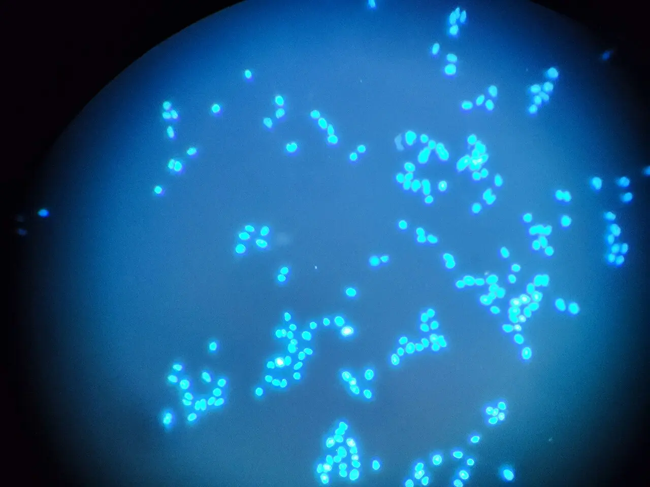 Fluorescence microscopy of DNA in oral cancer cells