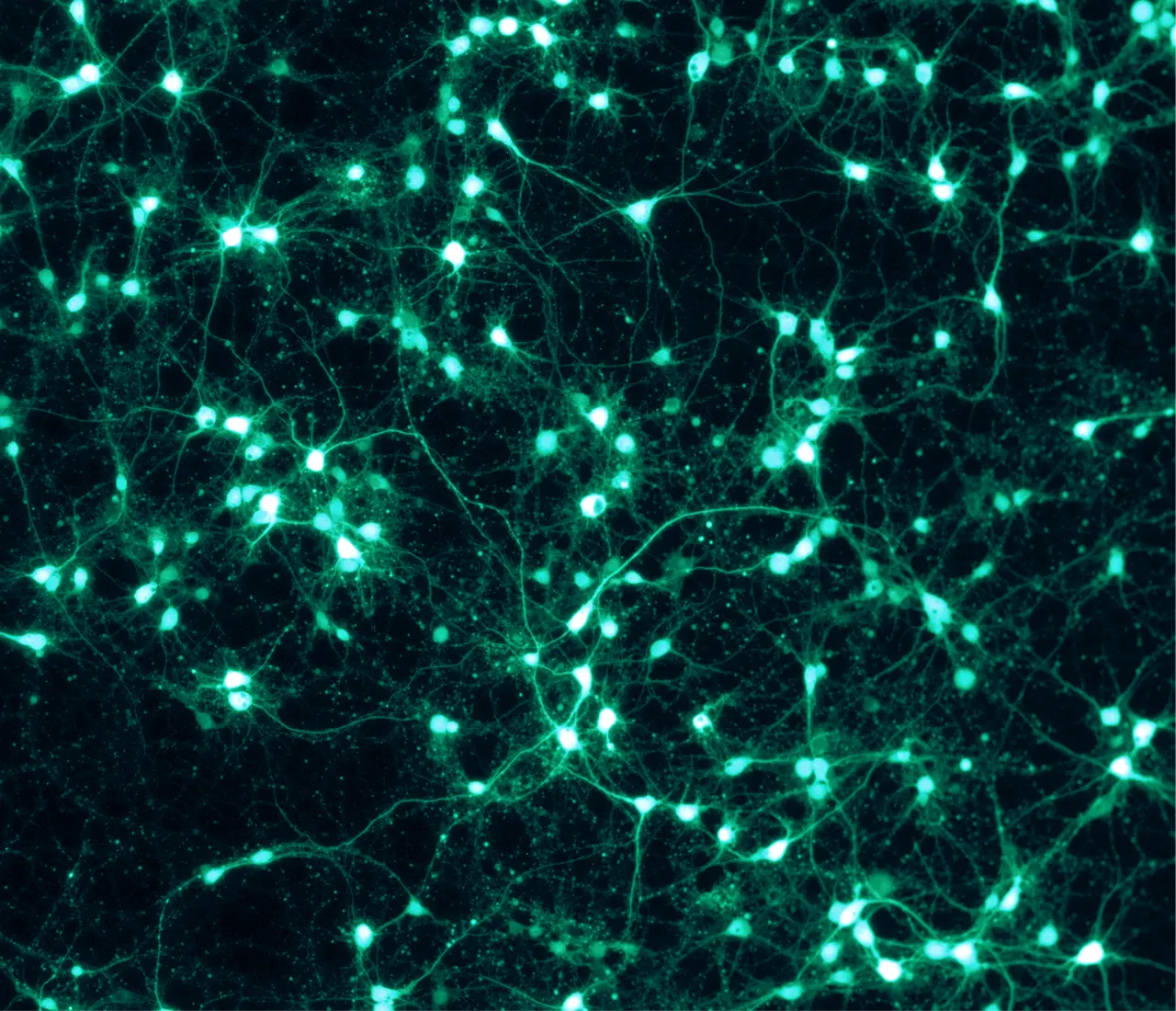 Green fluorescent neurons branching across a dark field