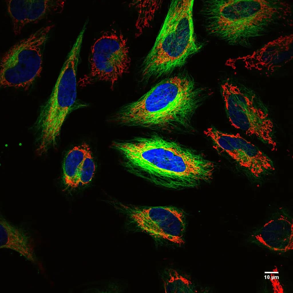 Living HeLa cells with nuclei, microtubules, and mitochondria shown in blue, green, and red