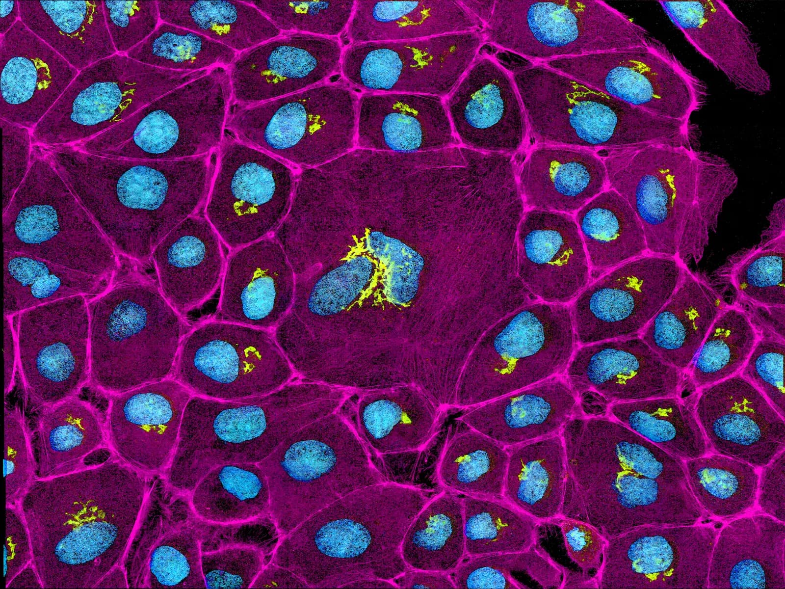 Cultured epithelial cells with Golgi in yellow-green, actin in magenta, and DNA in cyan